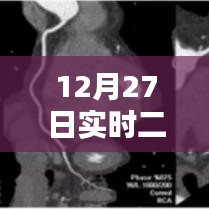 实时二维重建技术详解与应用解析