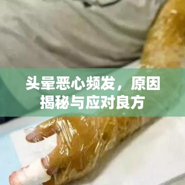 头晕恶心频发，原因揭秘与应对良方