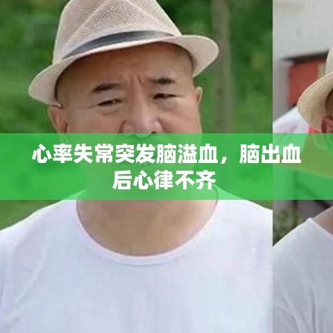 心率失常突发脑溢血,脑出血后心律不齐