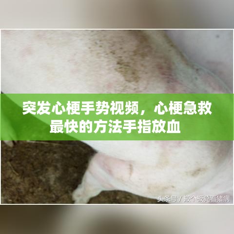 突发心梗手势视频，心梗急救最快的方法手指放血 