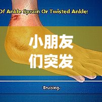 小朋友们突发的病有哪些,儿童突发性发烧