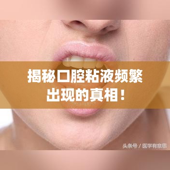 揭秘口腔粘液频繁出现的真相!