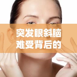 突发眼斜脑难受背后的真相揭秘